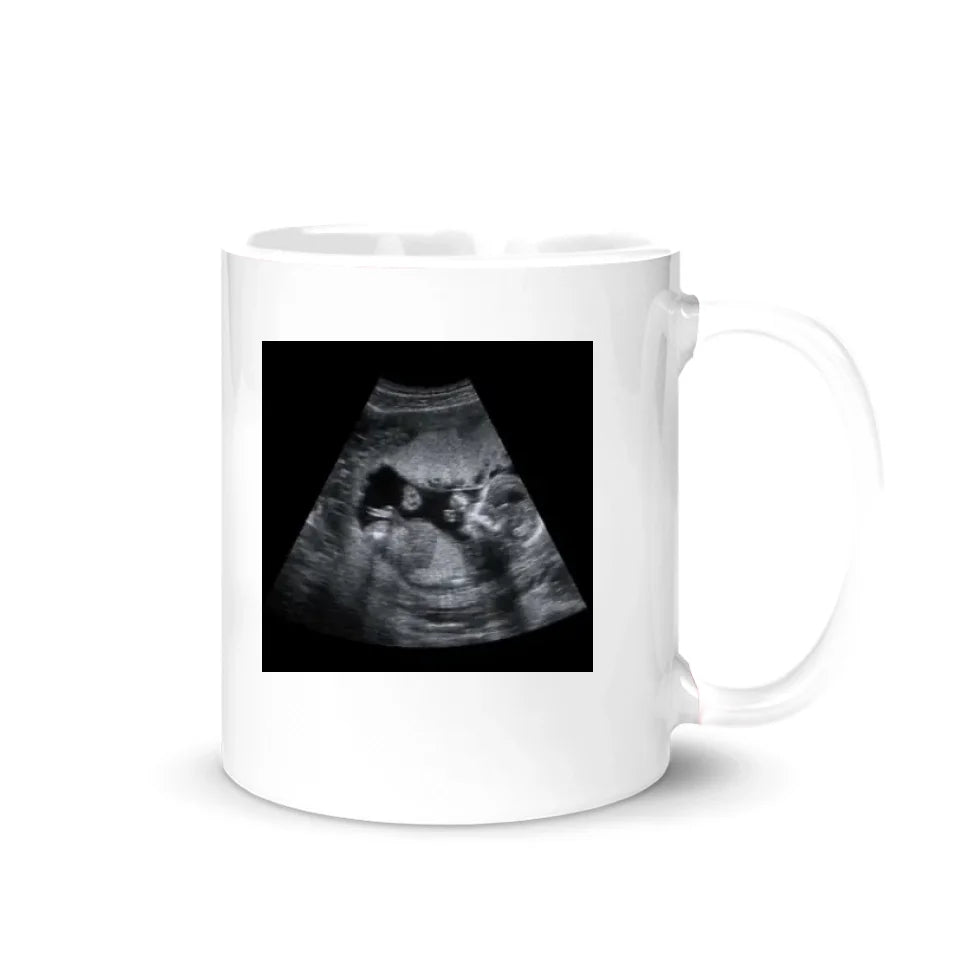 Selv om vi ikke har møttes ennå - tilpasset ultralydfotokrus til bestefar bestefar